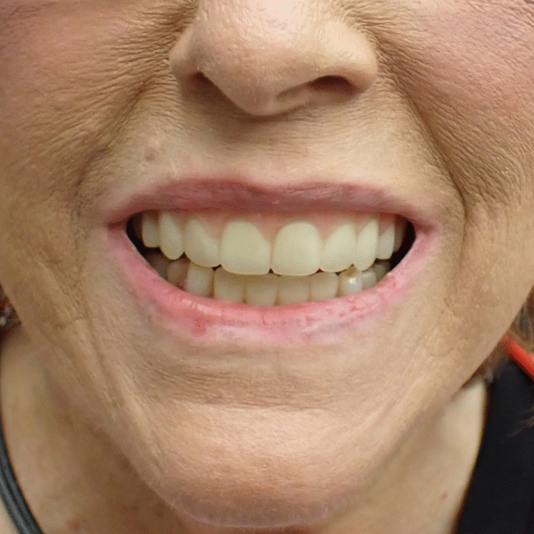 Something to Smile About: 3D Systems Announces Commercial Release of 3D Printed Denture Solution3DPrint.com | Additive Manufacturing Business 5 3d systems jetted dentures patient 6suFAW
