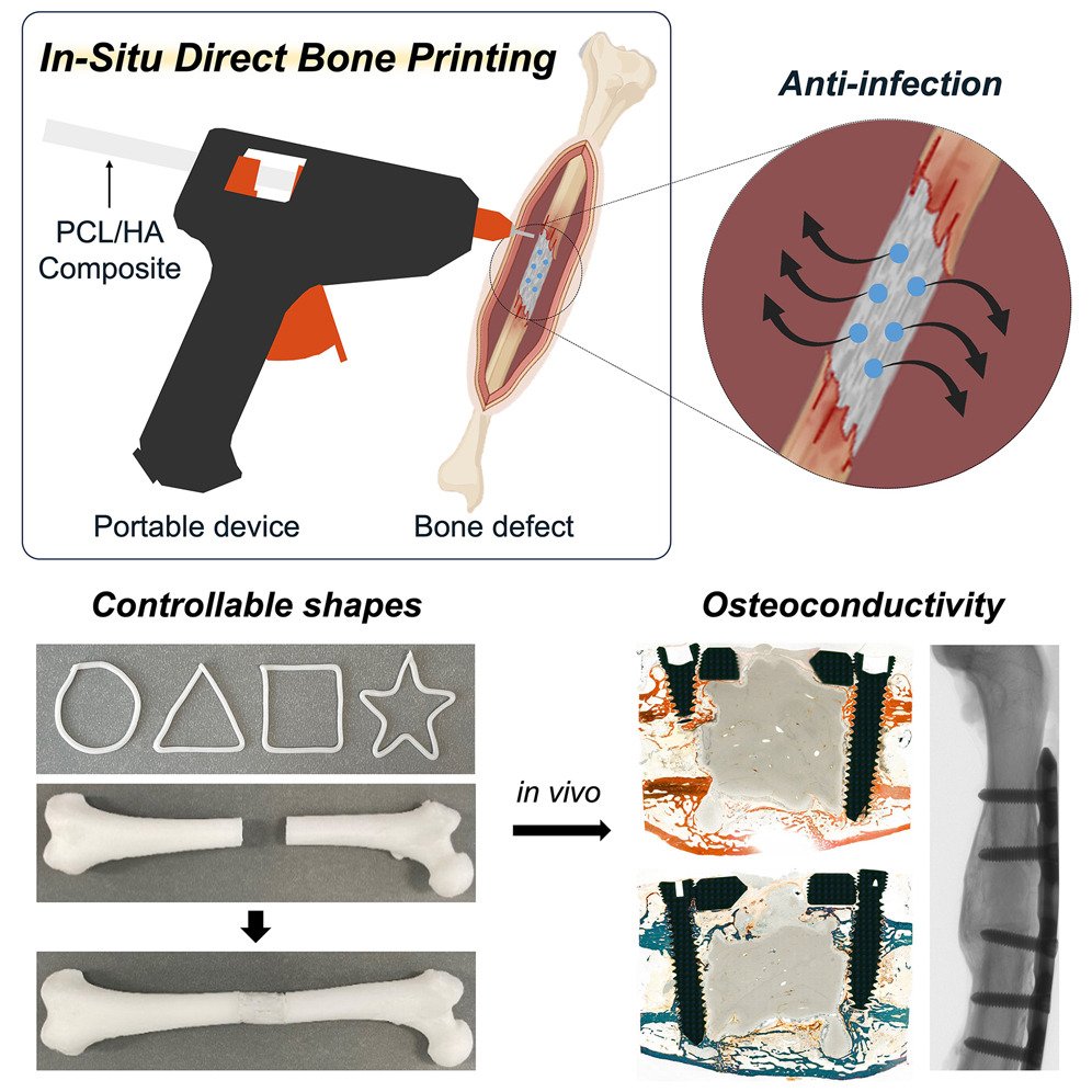 Handheld 3D Printer Repairs Bone Like a Glue Gun — Tested in Rabbits, Planned for OR Use3DPrint.com | Additive Manufacturing Business 2 Graphical abstract CREDIT Device Jeon et al AG2tJi