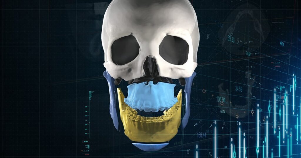 og mimics enlight cmf orthognathic skull nLZiGc