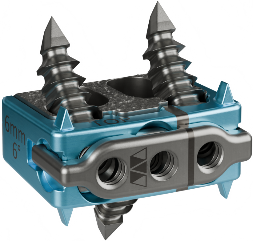 3D Printing News Briefs, August 13, 2026: 510(k) Clearance, Dental Resin, Project Call, & More3DPrint.com | Additive Manufacturing Business 2 665e474f7a50709959788e63 Saber C Beauty Implant Spikes 87KecS