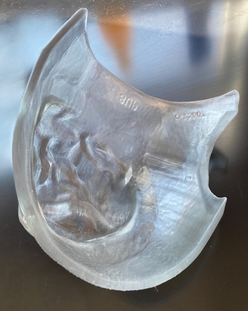 3D Printing News Briefs, October 14, 2026: Bolus, Aerospace Tooling, Water Filter, & More3DPrint.com | Additive Manufacturing Business 2 Myrava patient specific 3D printed bolus 818x1024